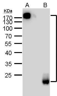 Mouse anti-Rat IgG (light chain) antibody [GT569] (HRP) detects Rat IgG (light chain) protein by Western blot analysis.